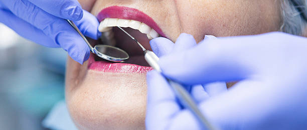 Best Root Canal Emergency Dentist  in Divernon, IL